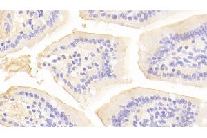 Detection of ACE2 in Mouse Small intestine Tissue using Polyclonal Antibody to Angiotensin I Converting Enzyme 2 (ACE2) (ACE2 Antikörper  (AA 93-464))