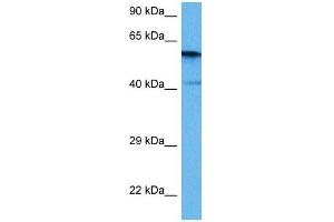 Western Blotting (WB) image for anti-Protein Phosphatase 3, Catalytic Subunit, alpha Isoform (PPP3CA) (Middle Region) antibody (ABIN2784524)