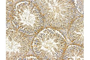 ABIN7096009 and ABIN7100071 at 1/100 staining rat testis tissue by IHC-P.