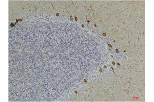 Immunohistochemistry (IHC) analysis of paraffin-embedded Human Brain Tissue using Ghrelin Receptor Rabbit Polyclonal Antibody diluted at 1:200. (GHSR Antikörper)