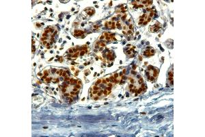 ABIN184913 (2µg/ml) staining of paraffin embedded Human Breast. (KAP1 Antikörper  (C-Term))
