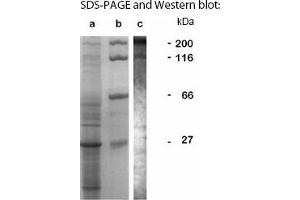 Western Blotting (WB) image for anti-LCCL Domain-Containing Protein CCP3 (LAP1) antibody (ABIN197620)