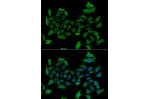 Immunofluorescence analysis of HeLa cells using ALAS1 antibody. (ALAS1 Antikörper)
