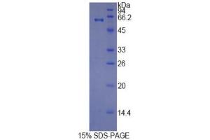 SDS-PAGE (SDS) image for Histidine-Rich Glycoprotein (HRG) (AA 18-254) protein (His tag,GST tag) (ABIN1170648)