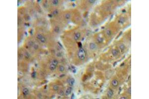 Used in DAB staining on fromalin fixed paraffin-embedded Liver tissue (TGFB1 Antikörper  (AA 279-390))