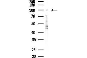 anti-Cyclic Nucleotide Gated Channel beta 1 (CNGB1) (Internal Region) antibody