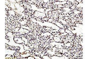 Formalin-fixed and paraffin embedded chicken lung labeled with Anti ApoER2 Polyclonal Antibody, Unconjugated (ABIN719426) at 1:200 followed by conjugation to the secondary antibody and DAB staining (LRP8 Antikörper  (AA 851-963))