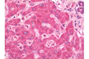 anti-alpha-Kinase 2 (ALPK2) (C-Term) antibody