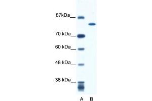 WB Suggested Anti-KIF23 Antibody Titration:  0. (KIF23 Antikörper  (N-Term))