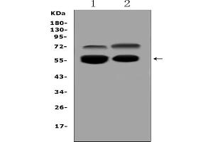 Western blot analysis of VNN1 using anti-VNN1 antibody (ABIN4886761).