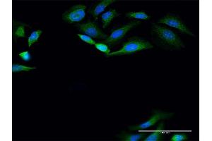 Immunofluorescence (IF) image for anti-Pantothenate Kinase 4 (PANK4) (AA 1-773) antibody (ABIN949435)