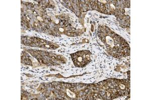 IHC analysis of Claudin 3/CLDN3 using anti-Claudin 3/CLDN3 antibody (ABIN7599626). (Claudin 3 Antikörper  (AA 101-220))