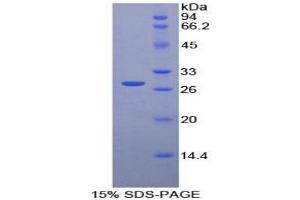 SDS-PAGE analysis of Rat Pyridoxal Kinase Protein. (PDXK Protein)
