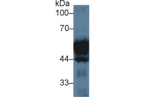 Western Blot; Sample: Rat Small intestine lysate; Primary Ab: 3µg/ml Rabbit Anti-Rat KRT20 Antibody Second Ab: 0. (KRT20 Antikörper  (AA 75-382))