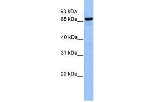 WB Suggested Anti-MTA2  Antibody Titration: 0. (MTA2 Antikörper  (Middle Region))