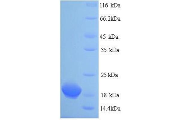 CLTCL1 Protein (AA 1423-1566) (His tag)