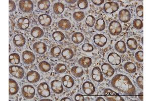 Immunoperoxidase of monoclonal antibody to NDST1 on formalin-fixed paraffin-embedded human small Intestine. (NDST1 Antikörper  (AA 38-136))