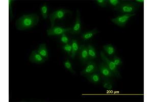 Immunofluorescence of monoclonal antibody to NFKB1 on HeLa cell. (NFKB1 Antikörper  (AA 860-969))
