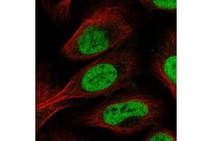 Immunofluorescent staining of human cell line U-2 OS with SFRS2IP polyclonal antibody  at 1-4 ug/mL dilution shows positivity in nucleus but not nucleoli.