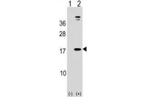 Western blot analysis of LEP antibody and 293 cell lysate (2 ug/lane) either nontransfected (Lane 1) or transiently transfected (2) with the human gene. (Leptin Antikörper  (AA 8-37))