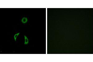 Peptide - +Western blot analysis of extracts from HUVEC cells, using FZD3 antibody. (FZD3 Antikörper  (Internal Region))