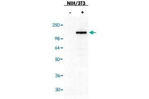 Western blot using ASAP3 polyclonal antibody  shows detection of ASAP3 in NIH/3T3 cells over-expressing the protein.