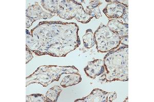 Immunohistochemistry of paraffin-embedded human placenta using Placental lactogen (CSH1) (CSH1) Rabbit mAb (ABIN7266353) at dilution of 1:100 (40x lens). (CSH1 Antikörper)