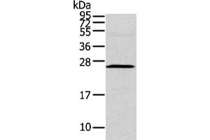 Gel: 12 % SDS-PAGE, Lysate: 40 μg, Lane: Human fetal intestines tissue, Primary antibody: ABIN7190229(CFC1 Antibody) at dilution 1/200 dilution, Secondary antibody: Goat anti rabbit IgG at 1/8000 dilution, Exposure time: 2 minutes (CFC1 Antikörper)