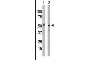 The anti-BCKDK Pab (ABIN391130 and ABIN2841253) is used in Western blot to detect BCKDK in mouse intestine tissue lysate (Lane 1) and Hela cell lysate (Lane 2). (BCKDK Antikörper  (C-Term))