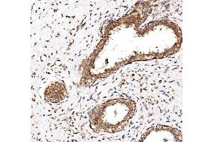 IHC analysis of NDP52/CALCOCO2 using anti-NDP52/CALCOCO2 antibody (ABIN7599401). (CALCOCO2 Antikörper  (AA 1-446))
