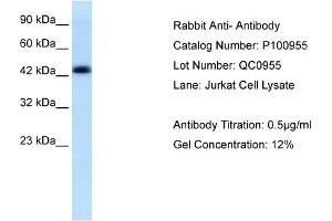 Lane: Jurkat cell LysateAntibody Dilution: 0. (Anti-MBP-1 (Middle Region) Antikörper)