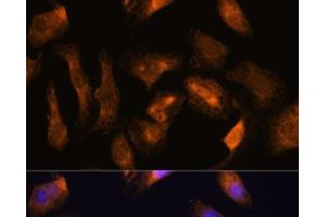 Immunofluorescence analysis of U-2 OS cells using RPS17 Polyclonal Antibody at dilution of 1:100. (RPS17 Antikörper)