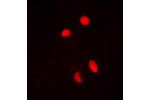 Immunofluorescence (IF) image for anti-Heat Shock Factor Protein 1 (HSF1) (pSer303) antibody (ABIN7300840)