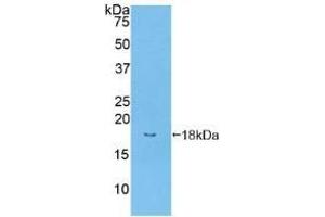Western Blotting (WB) image for anti-Bone Morphogenetic Protein Receptor, Type II (serine/threonine Kinase) (BMPR2) (AA 27-150) antibody (ABIN7439651)
