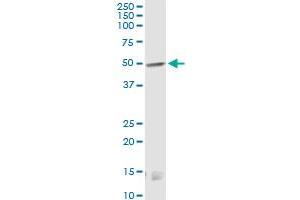 CNR1 monoclonal antibody (M01), clone 2F9. (CNR1 Antikörper  (AA 1-110))