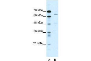 WB Suggested Anti-ACCN1 Antibody Titration:  0. (ACCN1 Antikörper  (C-Term))