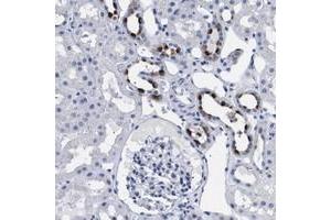 Immunohistochemical staining of human kidney with ATP6V0A4 polyclonal antibody  shows strong cytoplasmic positivity in cells in tubules at 1:50-1:200 dilution. (ATP6V0A4 Antikörper)