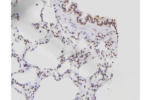 ABIN6261414 and ABIN6276538 at 1/100 staining Rat lung tissue by IHC-P.