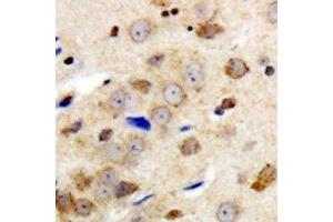 Immunohistochemical analysis of GABRG1 staining in human brain formalin fixed paraffin embedded tissue section. (GABRg1 Antikörper  (N-Term))