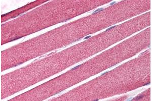 Human Skeletal Muscle (formalin-fixed, paraffin-embedded) stained with AICDA antibody ABIN214183 at 5 ug/ml followed by biotinylated goat anti-rabbit IgG secondary antibody ABIN481713, alkaline phosphatase-streptavidin and chromogen. (AICDA Antikörper  (C-Term))