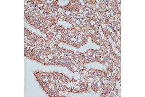 Immunohistochemistry of paraffin-embedded rat ovary using MOB4 antibody (ABIN6132926, ABIN6143935, ABIN6143936 and ABIN6220703) at dilution of 1:100 (40x lens).