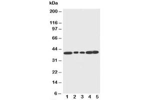 Western blot testing of Decorin antibody and Lane 1:  rat liver (Decorin Antikörper  (C-Term))
