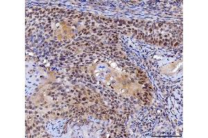 IHC analysis of MLH1 using anti-MLH1 antibody (ABIN7599691). (MLH1 Antikörper  (AA 108-756))