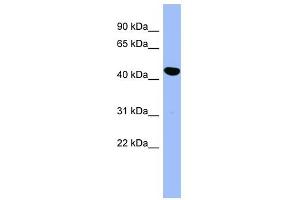 SERPINE2 antibody used at 1 ug/ml to detect target protein. (SERPINE2 Antikörper)