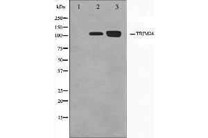Western blot analysis on Jurkat and K562 cell lysate using TRIM24 Antibody.