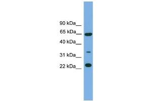 WB Suggested Anti-TRAPPC5 Antibody Titration: 0. (TRAPPC5 Antikörper  (N-Term))