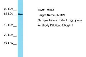 Host: Rabbit Target Name: INTS9 Sample Tissue: Human Fetal Lung Antibody Dilution: 1ug/ml (INTS9 Antikörper  (C-Term))