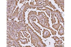 IHC analysis of YWHAE using anti-YWHAE antibody (ABIN7600163).