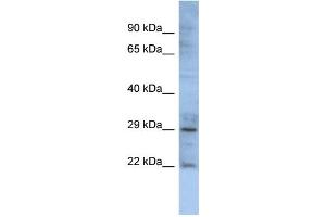 WB Suggested Anti-GJB1 Antibody Titration:  0. (GJB1 Antikörper  (Middle Region))