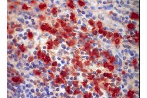 Image no. 1 for anti-S100 Calcium Binding Protein A9 (S100A9) antibody (ABIN379944) (S100A9 Antikörper)